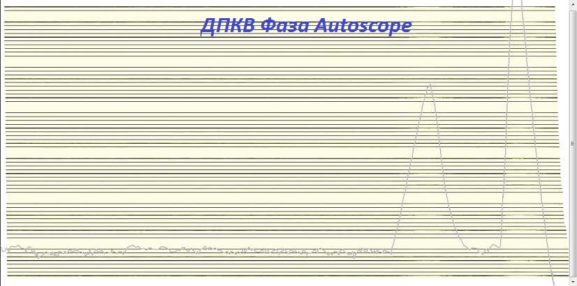 Фаза ДПКВ Autoscope.jpg